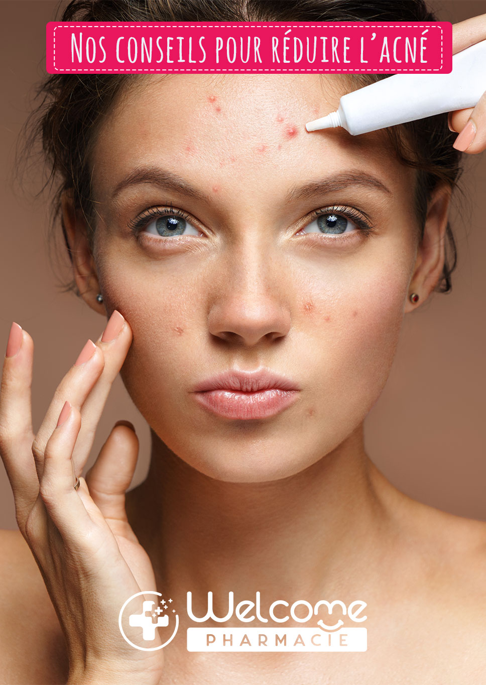 Les gestes simples à adopter pour réduire l’acné